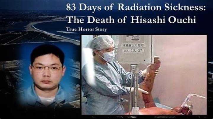 83 Days Hisashi Ouchi: A Deep Dive into the Photos and Story of a Tragic Incident