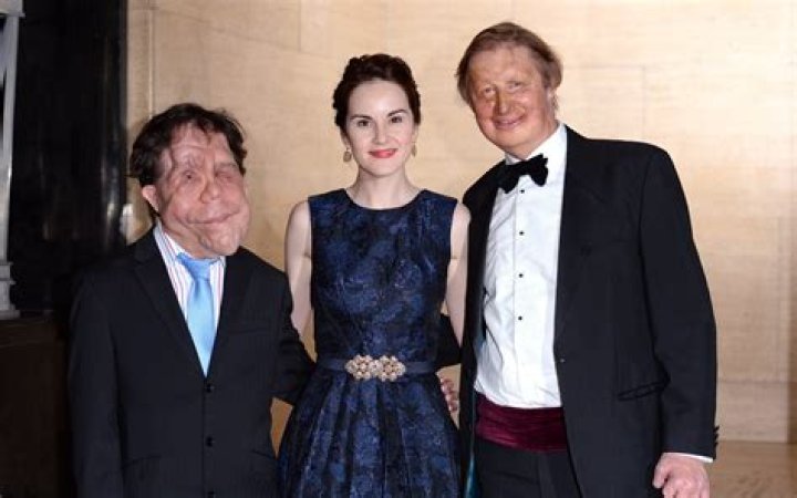 Unveiling the Life of Adam Pearson's Wife: A Journey of Love and Resilience