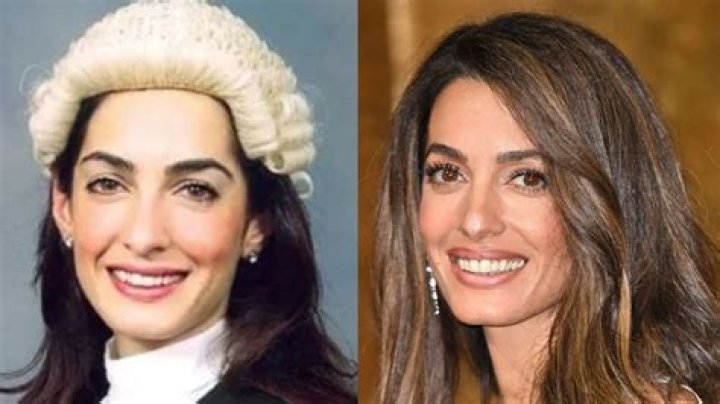 Discover Amal Clooney's Before Surgery Transformation