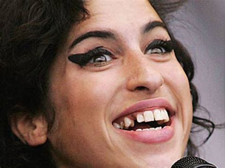 A Deep Dive into Amy Winehouse's Unique Smile: The Story Behind Her Tooth
