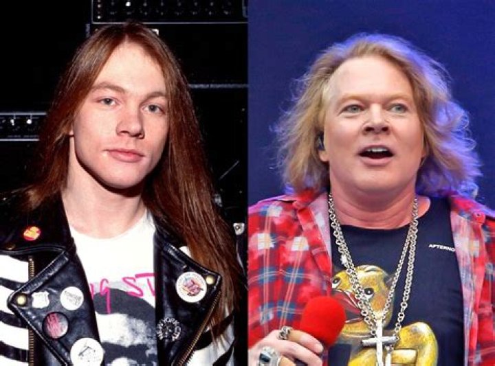 Axl Rose: The Evolution of a Rock Legend Now