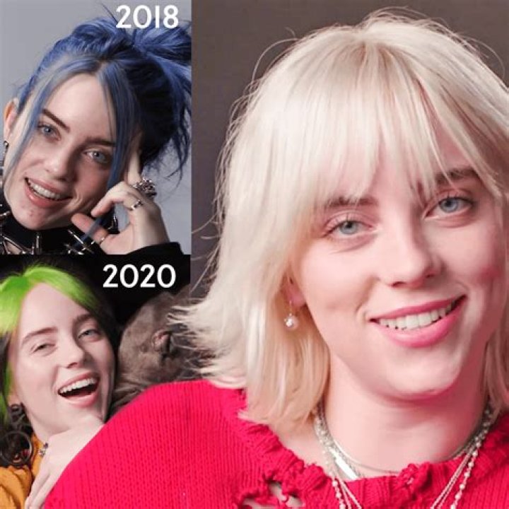 Billie Eilish Surgeries: Unveiling the Truth Behind the Pop Icon's Transformations