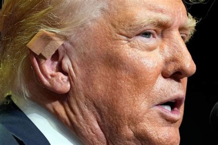Unveiling the Mystery Behind Damage to Trump's Ear