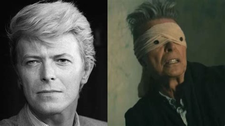 David Bowie: Understanding the Cause of Death and His Lasting Legacy