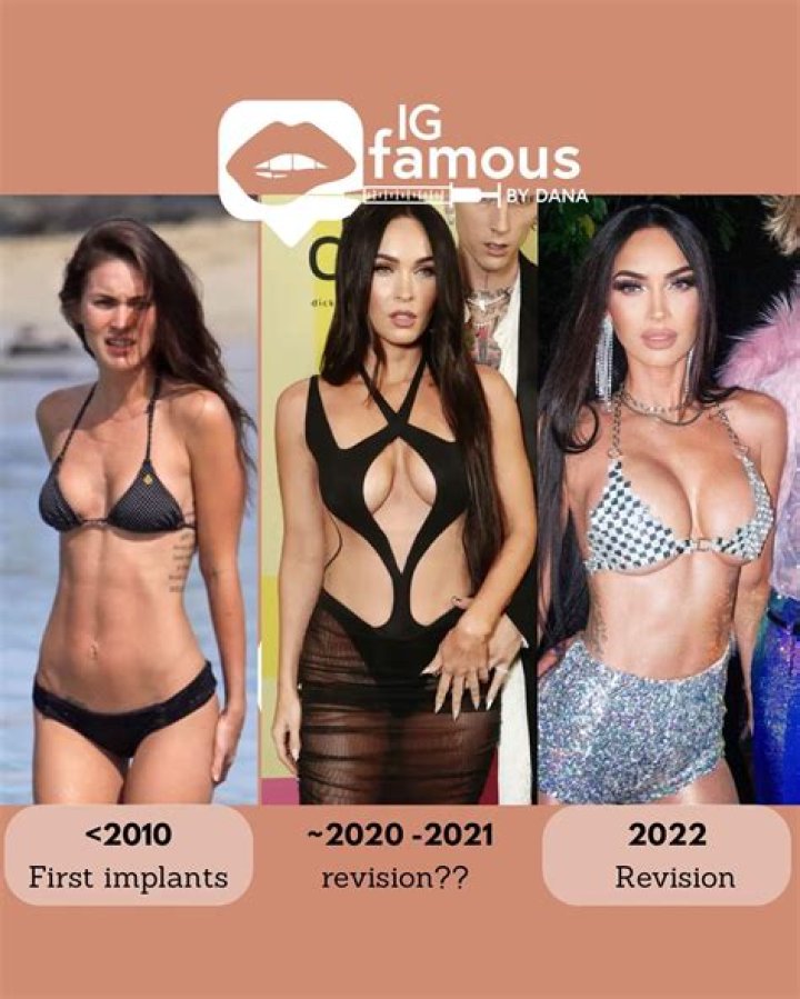 Did Megan Fox Get a Boob Job? Unraveling the Truth Behind Her Transformation
