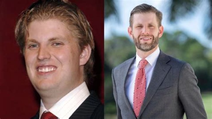 Unveiling the Truth Behind Eric Trump Plastic Surgery