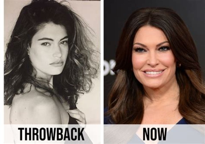 Guilfoyle Before and After: A Comprehensive Look at Transformation