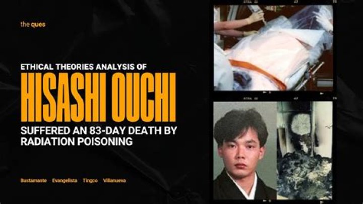 Hisashi Ouchi Graphic Photo: Understanding the Tragic Story Behind the Images