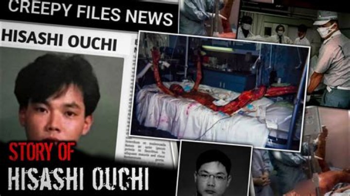Hisashi Ouchi Original Photo: A Deep Dive into the Tragic Story