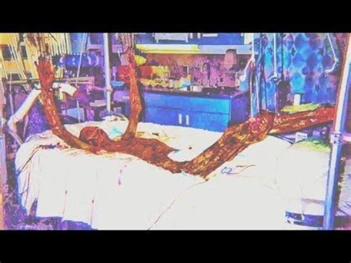 Hisashi Ouchi: The Real Body and the Tragic Story Behind It