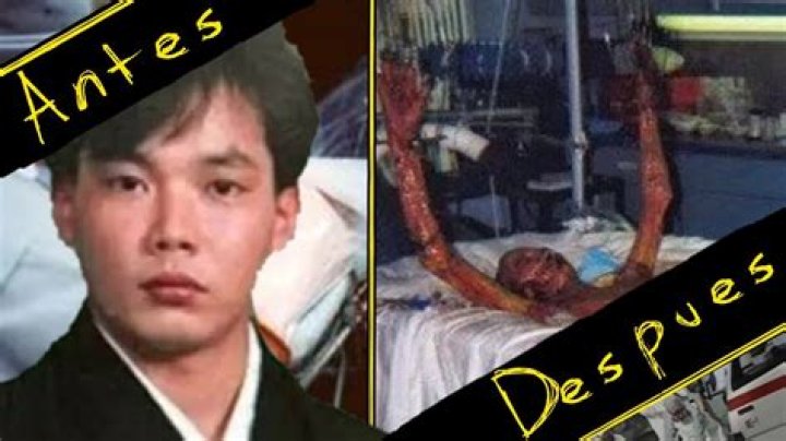 Hisashi Ouchi: The True Story Behind Real Photos from the Hospital