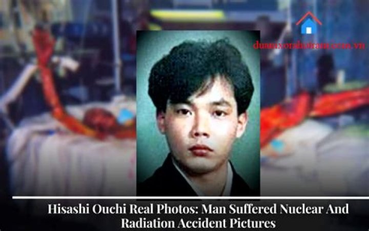 Hisashi Ouchi: The Tragic Story Behind the Real Photo
