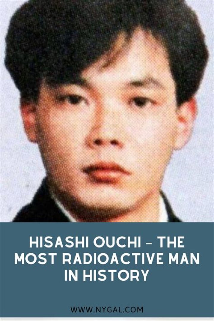 Hisashi Ouchi: The Tragic Story of the Japanese Nuclear Accident Victim