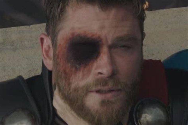 Unraveling the Mystery: How Did Thor Lose His Eye?