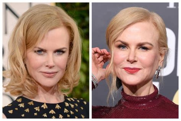 How Much Plastic Surgery Has Nicole Kidman Had? Unveiling the Truth Behind Her Youthful Appearance
