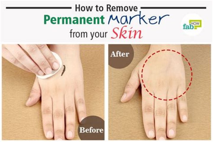 Effective Methods to Remove Marker Stains from Skin