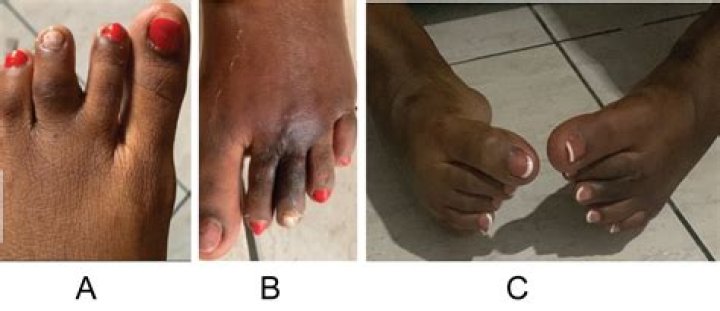 Exploring the Fascination of Interlocked Toes