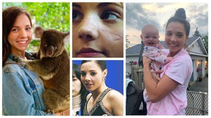 Jessica Dube: A Journey Through Injury and Recovery