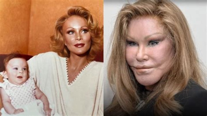 Jocelyn Wildenstein: The Enigmatic Transformation Before Any Surgery