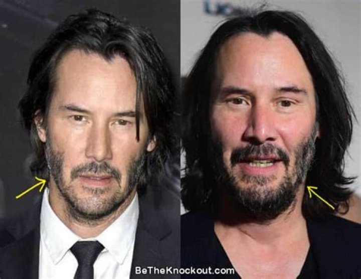 Unveiling the Truth Behind Keanu Reeves Plastic Surgery