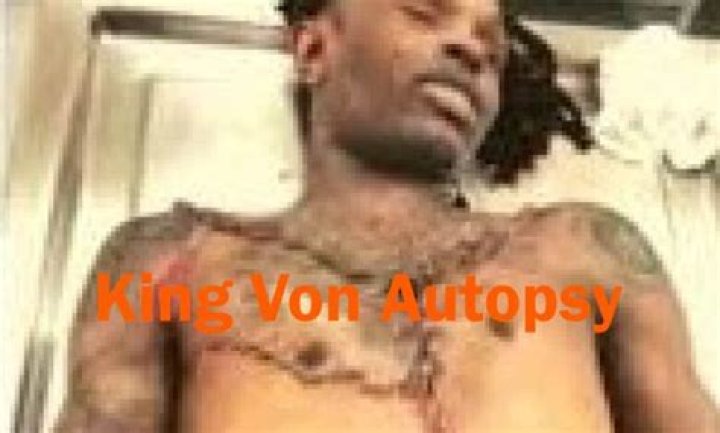 Unraveling the Mystery: King Von Autopsy Picture and Its Impact