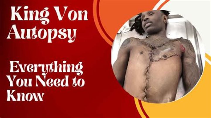 Unraveling the Mystery of King Von's Death Autopsy