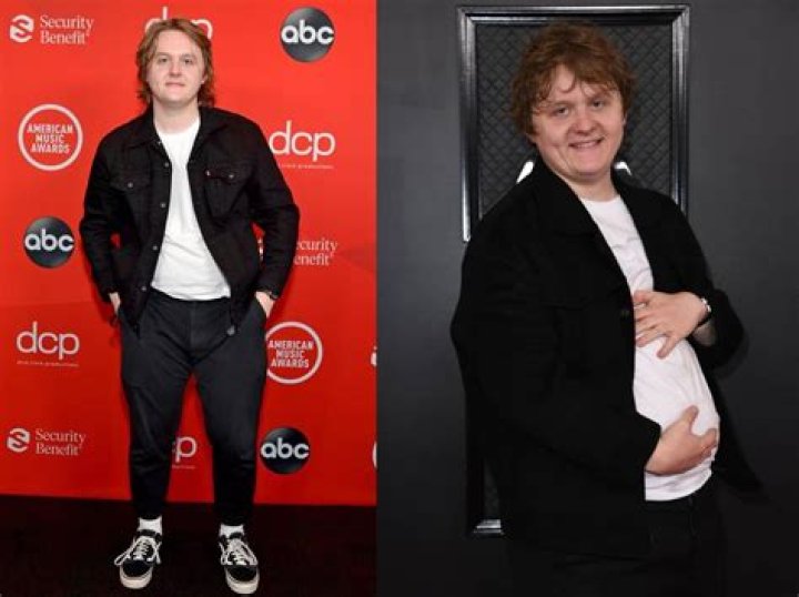 Understanding Lewis Capaldi's Weight Gain: A Comprehensive Insight