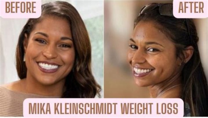 Mika Kleinschmidt Weight Loss: Journey to a Healthier Lifestyle