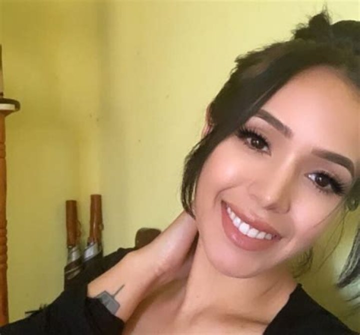 **The Transformation Journey: Minitinah Before Surgery**