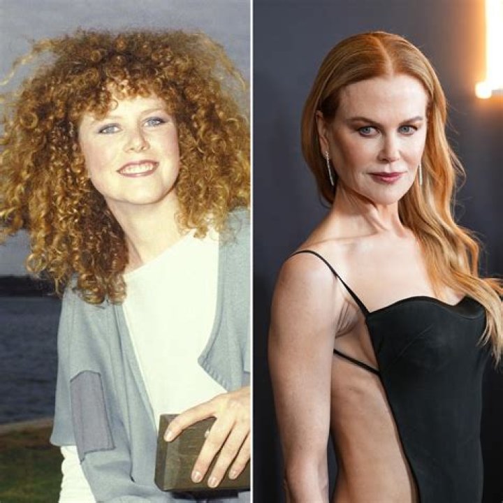Nicole Kidman Plastic Surgery: Unveiling the Truth Behind Her Transformation