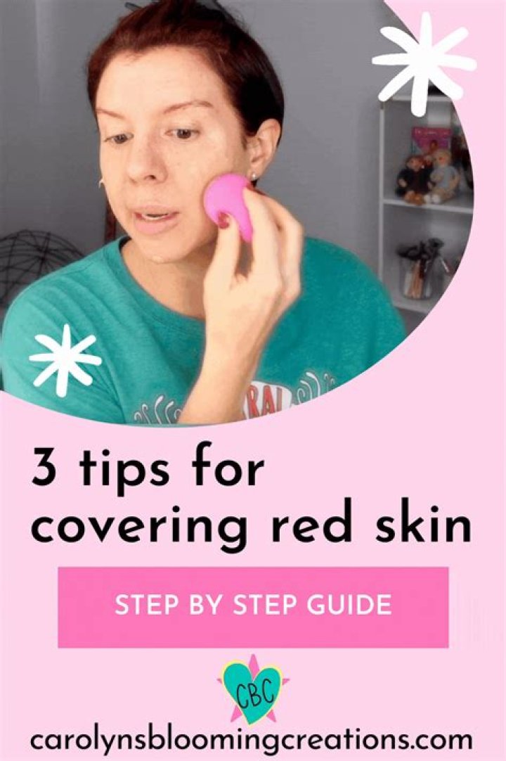 Pimple Coverage: Your Ultimate Guide to Concealing and Managing Acne