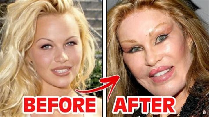 Plastic Surgery Celebrities: The Transformation of Fame