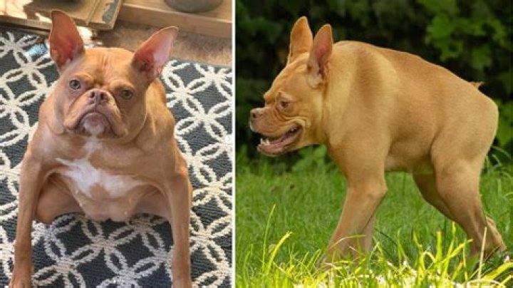 Understanding Short Spine Syndrome: Causes, Symptoms, and Treatment