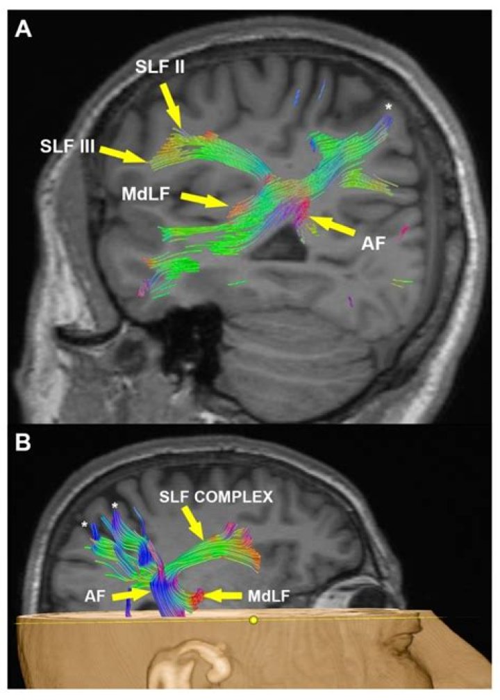 Understanding Temporal Interference in fMRI: A Comprehensive Guide