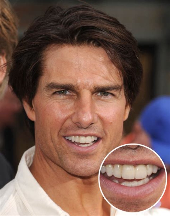 Exploring the Iconic Smile of Tom Cruise: The Middle Tooth Phenomenon