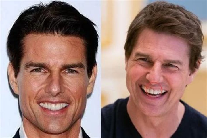 Tom Cruise Tooth: The Iconic Smile Behind the Hollywood Star