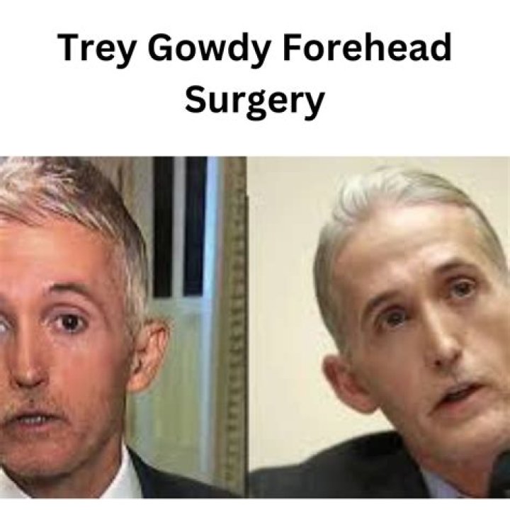 Trey Gowdy's Transformation: The Nose Job Controversy