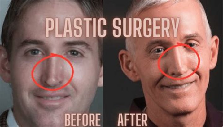 Trey Gowdy: The Truth Behind His Plastic Surgery Rumors
