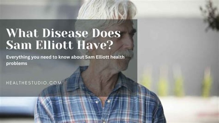Unraveling the Mystery: What Disease Does Sam Elliott Have?